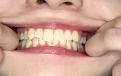 キャプチャ画像9